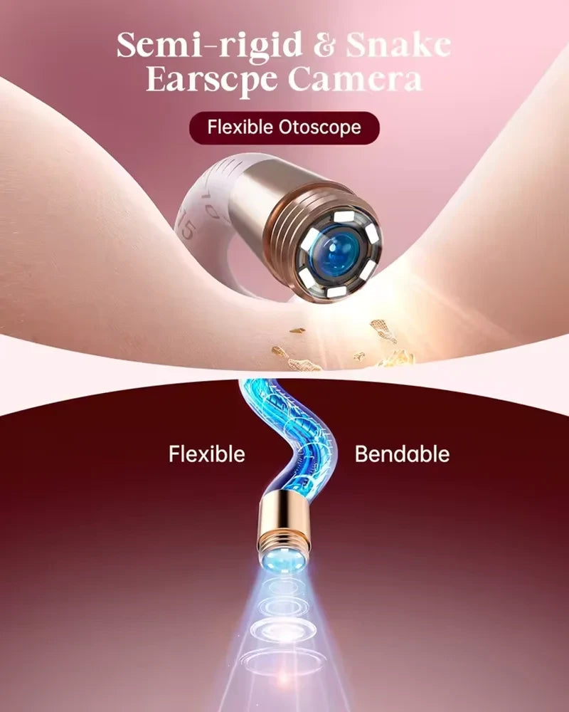 Bebird EarSight Plus Visual Ear Cleaner