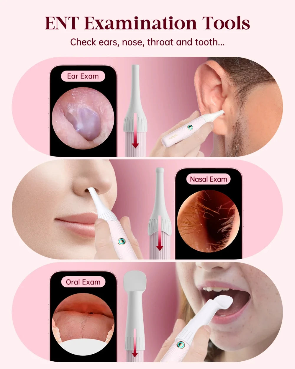 Bebird EarSight Plus Visual Ear Cleaner